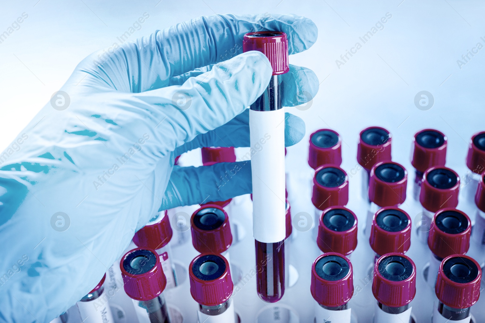 Image of Laboratory worker putting sample tube with blood and blank label into rack, closeup. Medical analysis