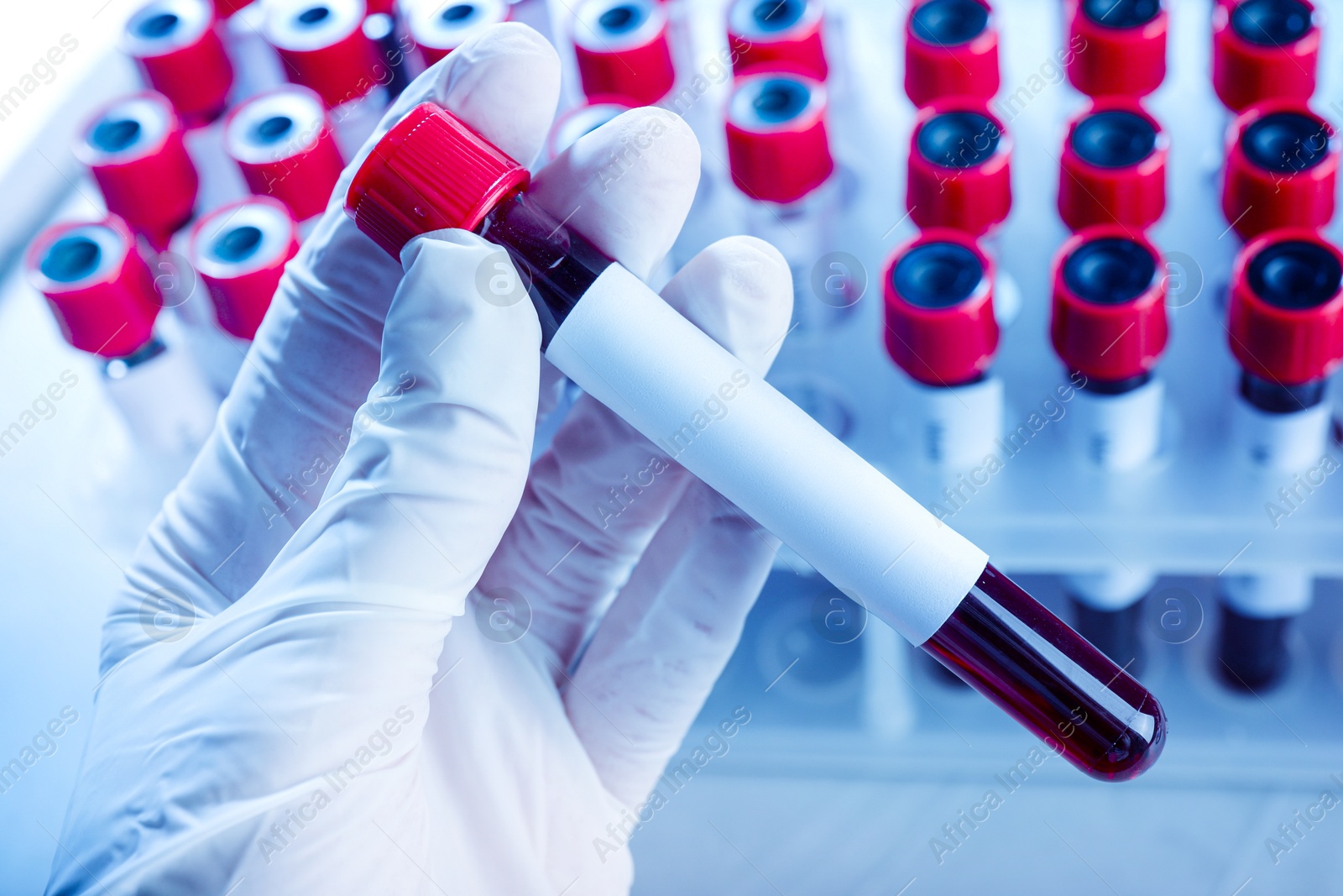 Image of Laboratory worker putting sample tube with blood and blank label near rack, closeup. Medical analysis