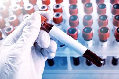 Laboratory worker putting sample tube with blood and blank label near rack, closeup. Medical analysis