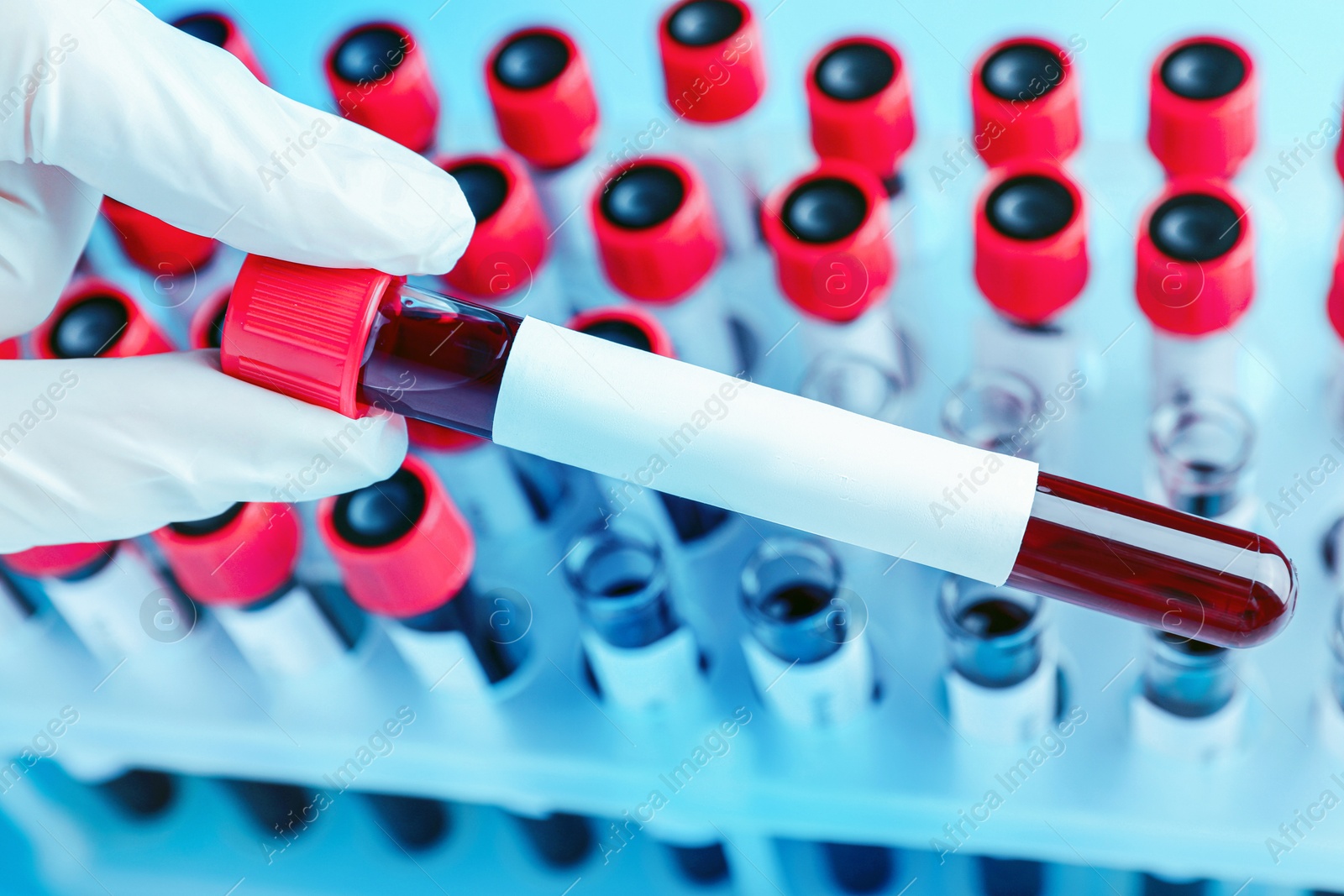 Image of Laboratory worker putting sample tube with blood and blank label over rack, closeup. Medical analysis