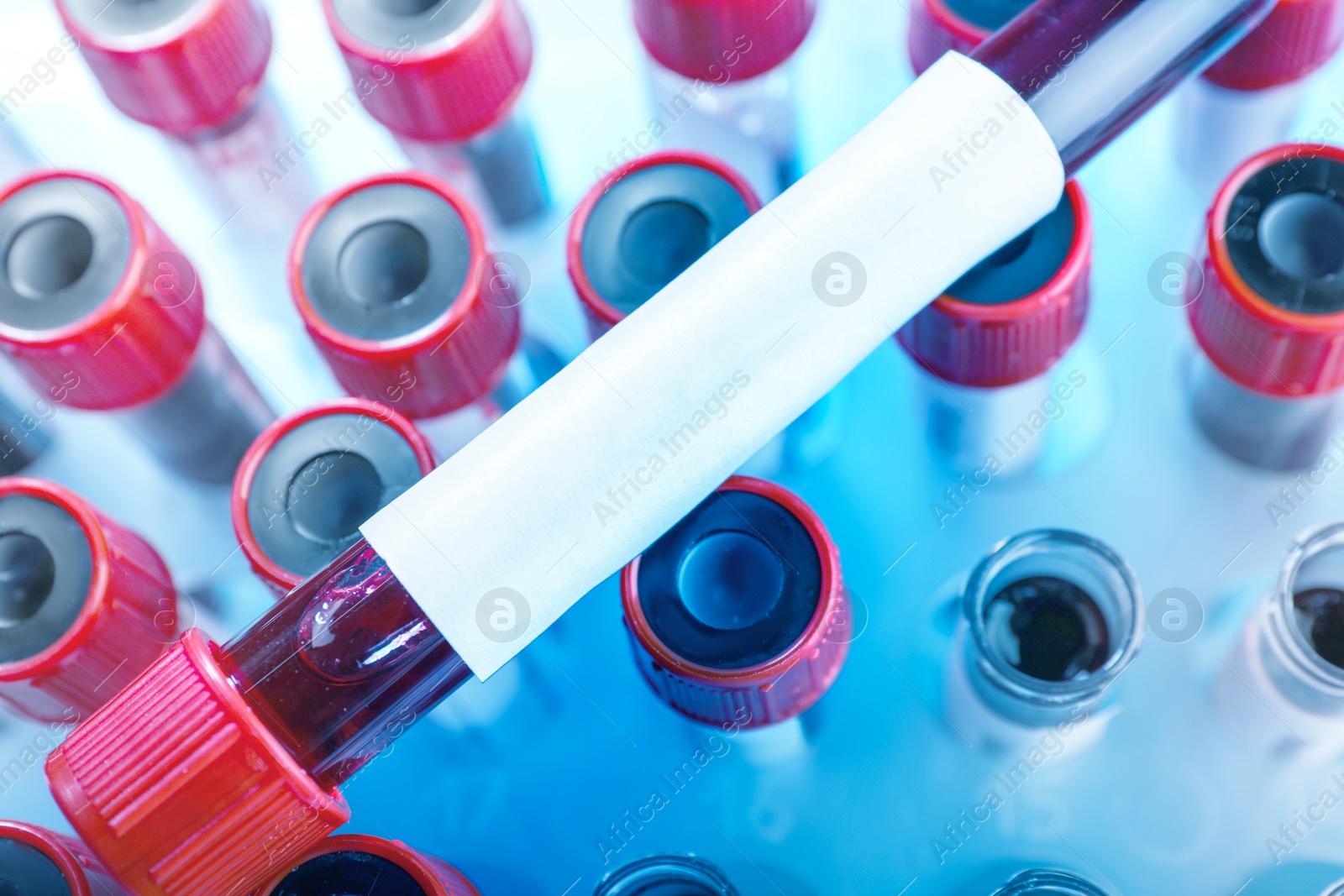 Image of One sample tube with blood and blank label on others, closeup. Laboratory analysis