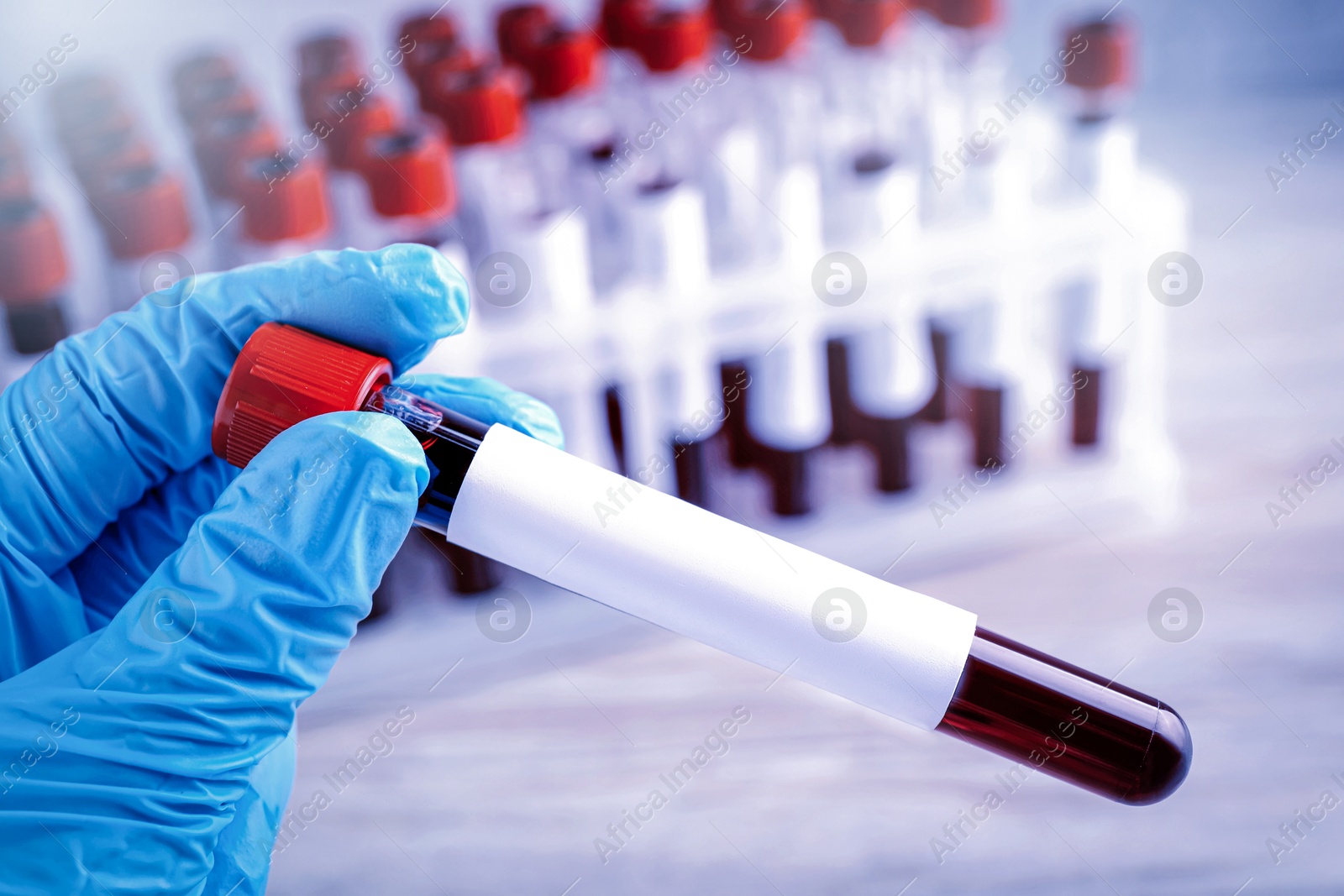 Image of Laboratory worker holding test tube with blood sample and blank label over table, closeup. Medical analysis