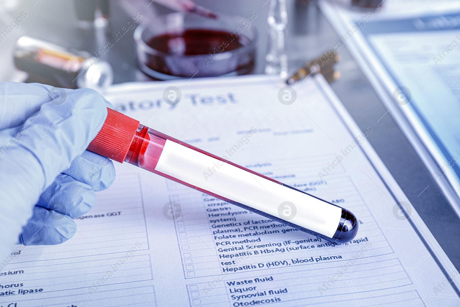 Image of Laboratory worker holding test tube with blood sample and blank label at table, closeup. Medical analysis