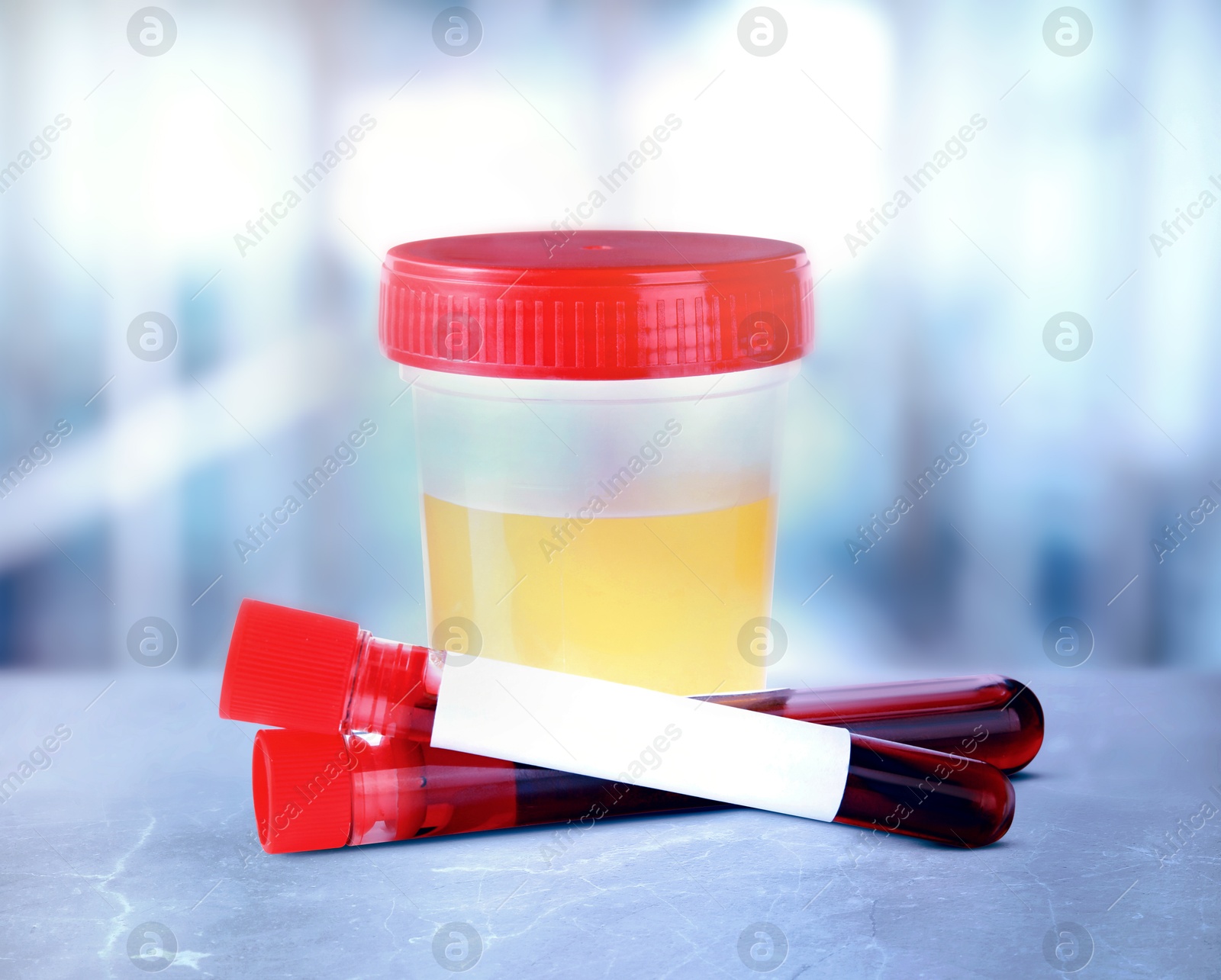 Image of Test tubes with blood samples and jar of urine on table in laboratory. Medical analysis