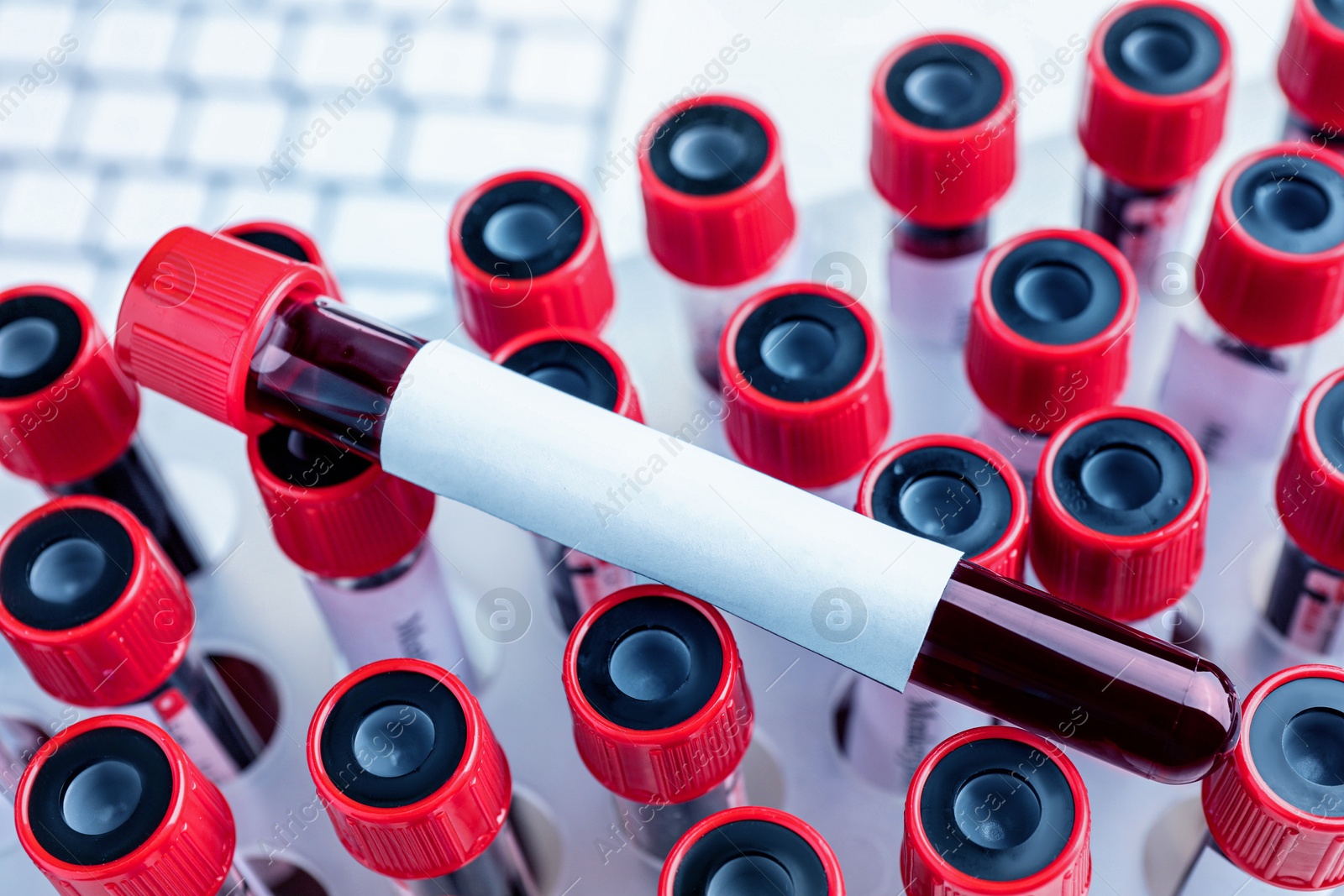 Image of One sample tube with blood and blank label on others, closeup. Laboratory analysis