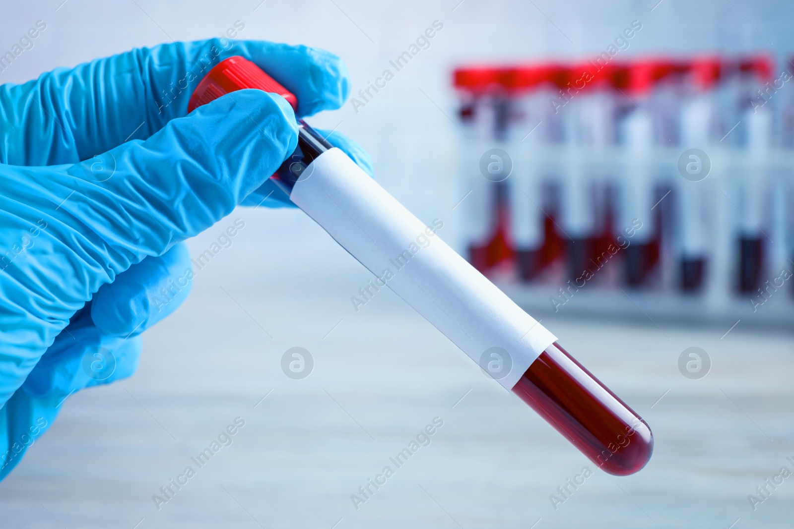 Image of Laboratory worker holding test tube with blood sample and blank label over table, closeup. Medical analysis