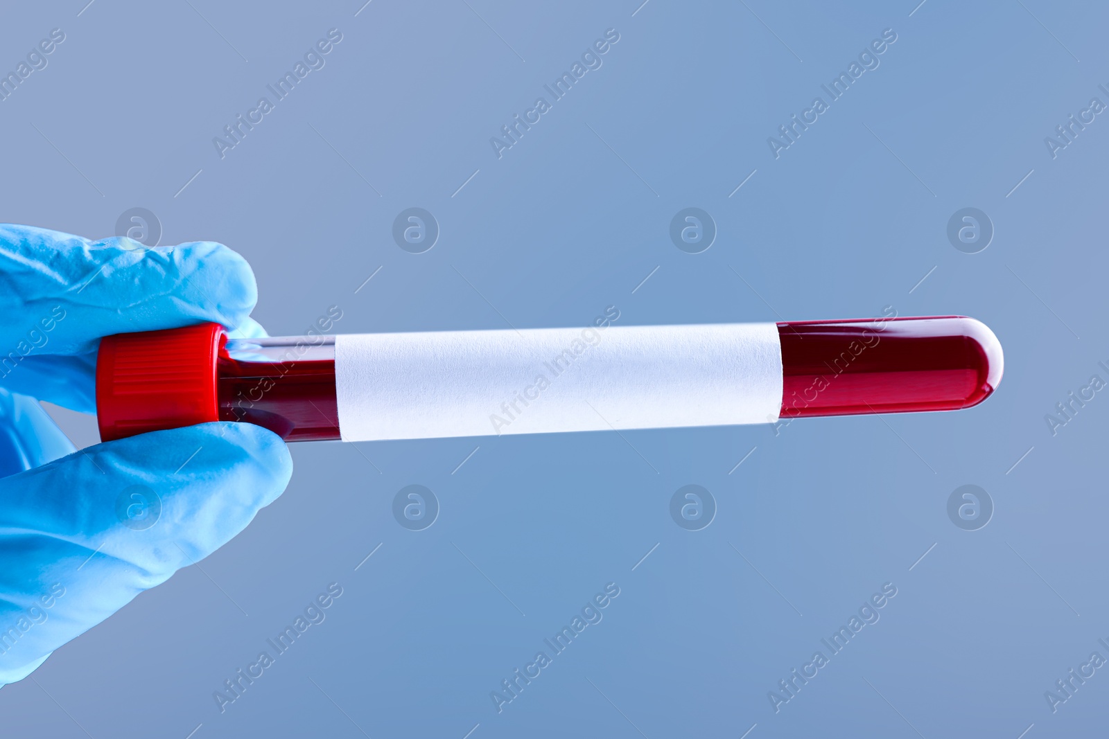 Image of Laboratory worker holding test tube with blood sample and blank label on grey background, closeup. Medical analysis