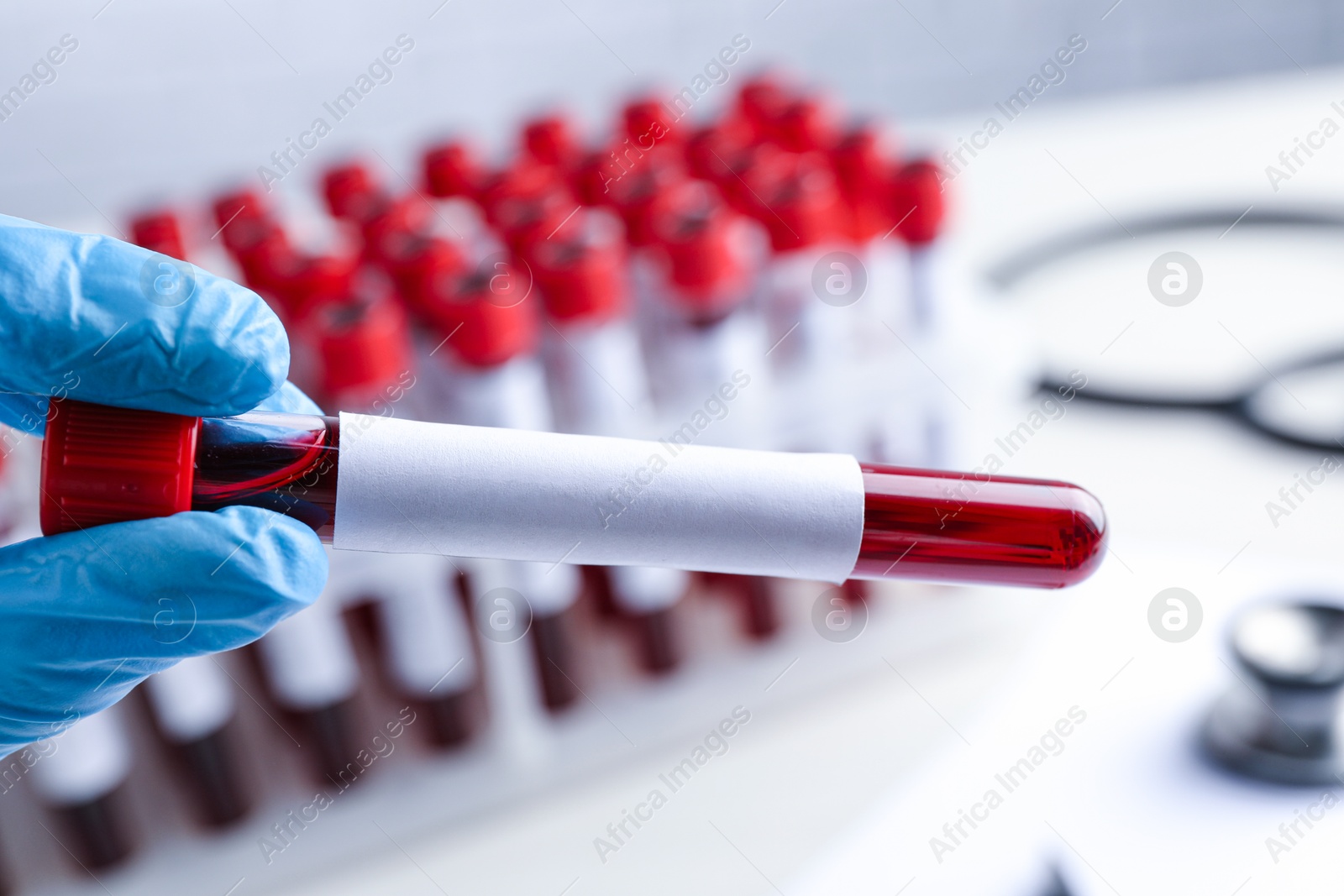 Image of Laboratory worker holding test tube with blood sample and blank label over table, closeup. Medical analysis