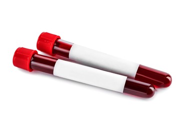 Image of Blood in test tubes with blank labels on white background. Medical analysis