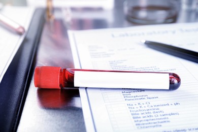 Blood in test tube with blank label on table, closeup. Laboratory analysis