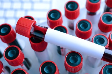 Image of One sample tube with blood and blank label on others, closeup. Laboratory analysis