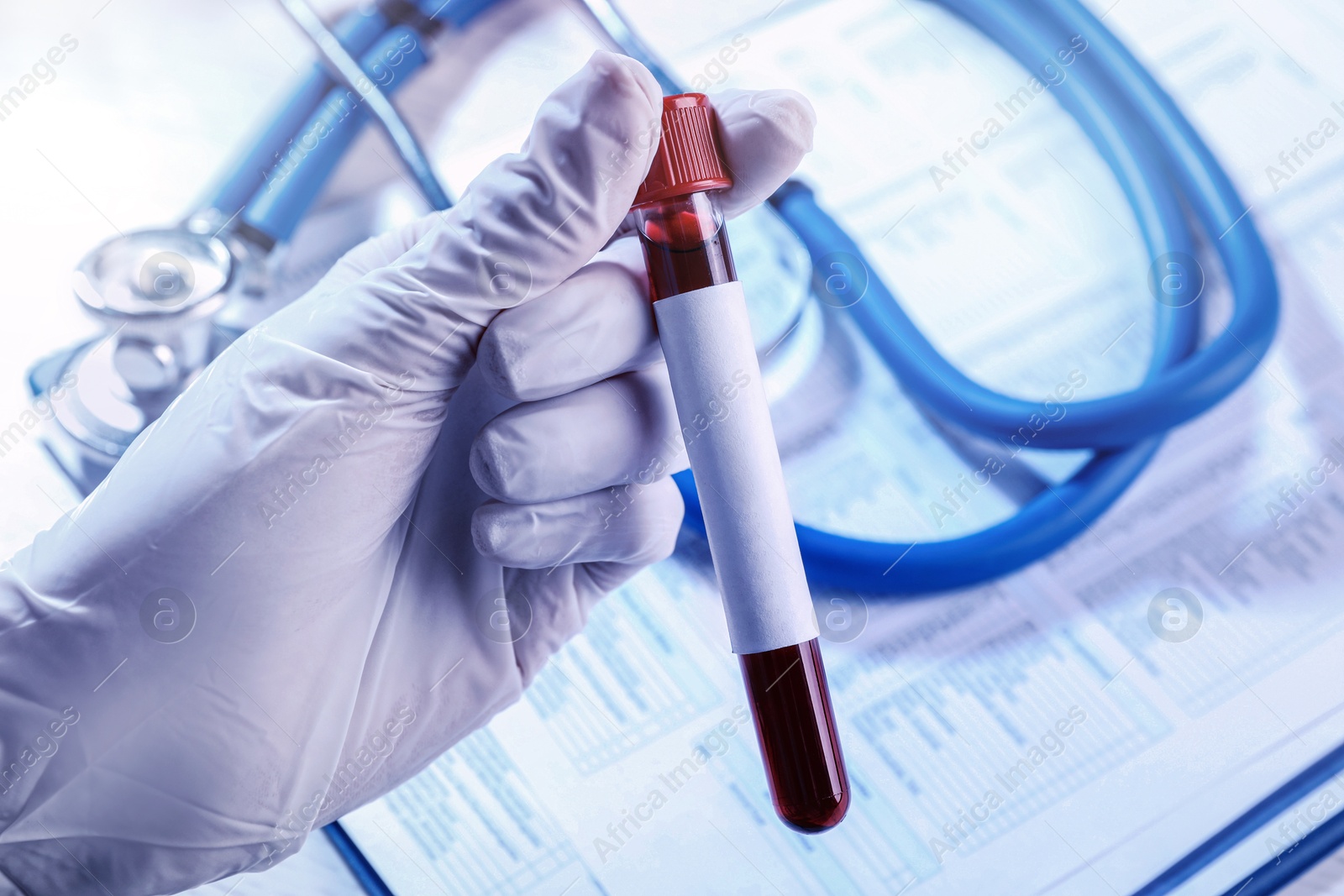 Image of Laboratory worker holding test tube with blood sample and blank label over table, closeup. Medical analysis