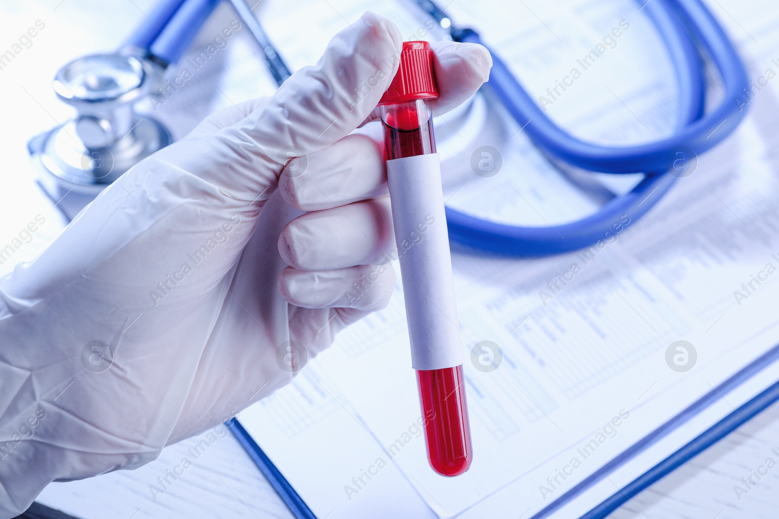 Image of Laboratory worker holding test tube with blood sample and blank label over table, closeup. Medical analysis