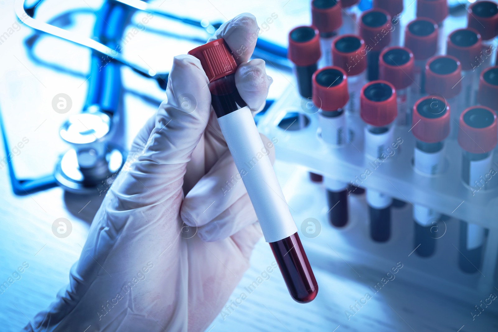 Image of Laboratory worker holding test tube with blood sample and blank label over table, closeup. Medical analysis