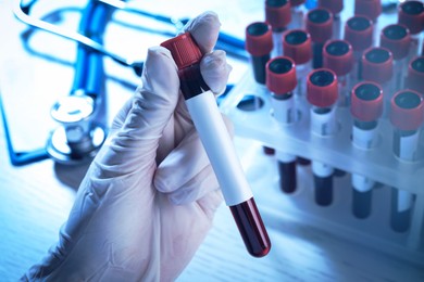 Image of Laboratory worker holding test tube with blood sample and blank label over table, closeup. Medical analysis