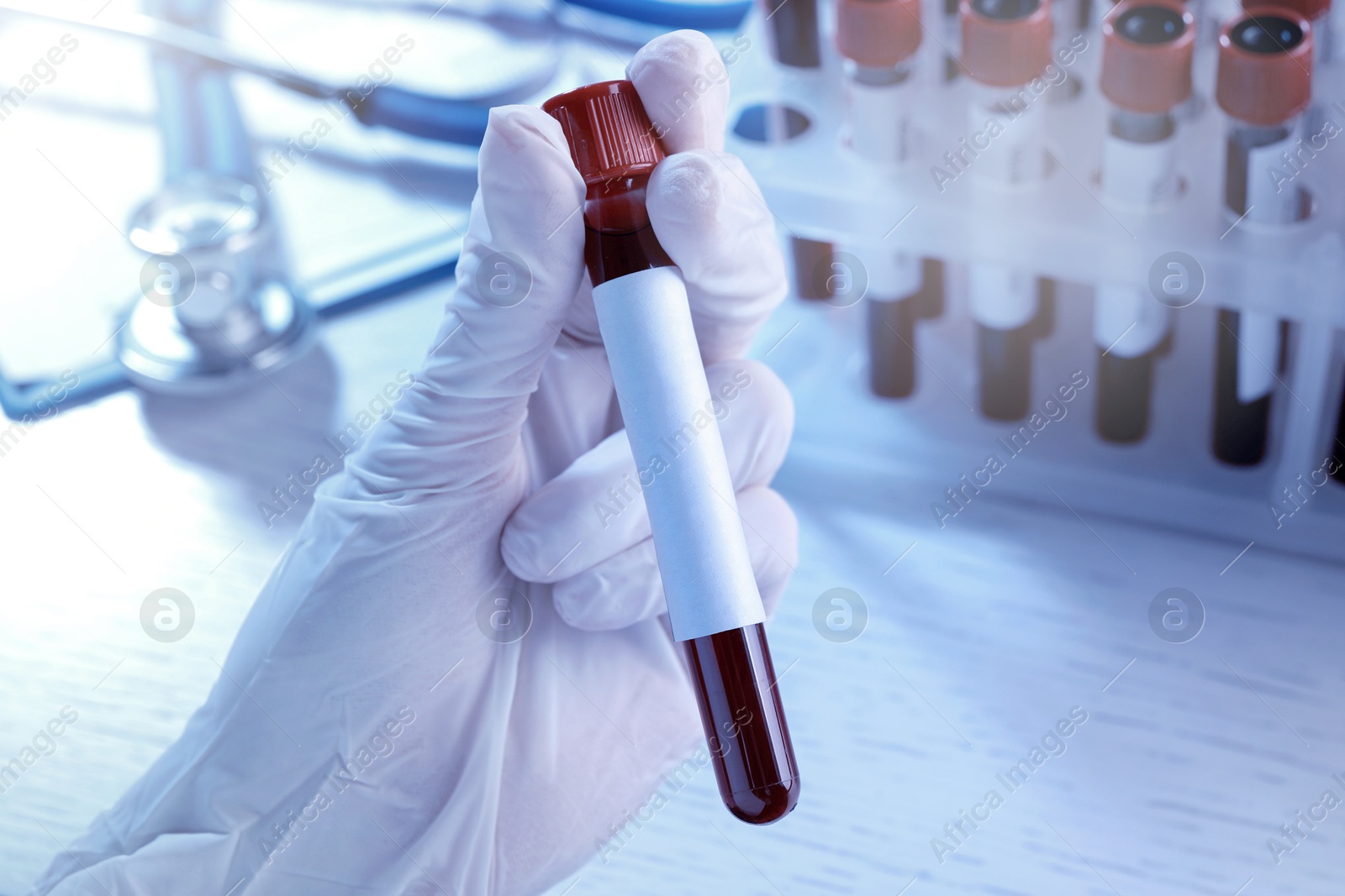 Image of Laboratory worker holding test tube with blood sample and blank label over table, closeup. Medical analysis