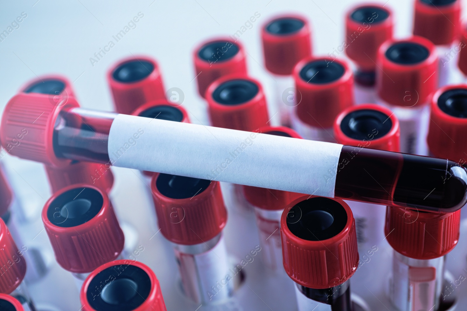 Image of One sample tube with blood and blank label on others, closeup. Laboratory analysis