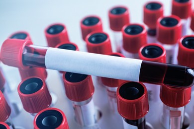 Image of One sample tube with blood and blank label on others, closeup. Laboratory analysis