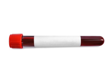 Blood in test tube with blank label on white background. Medical analysis