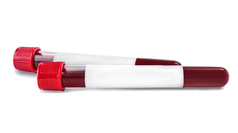 Blood in test tubes with blank labels on white background. Medical analysis