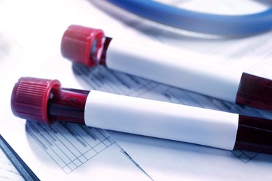 Blood in test tubes with blank labels on medical forms, closeup. Laboratory analysis