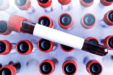 Image of One sample tube with blood and blank label on others, closeup. Laboratory analysis