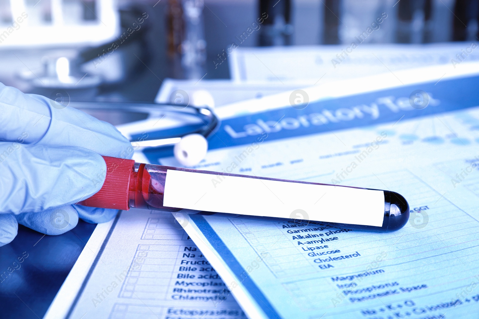 Image of Laboratory worker holding test tube with blood sample and blank label at table, closeup. Medical analysis