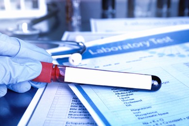 Laboratory worker holding test tube with blood sample and blank label at table, closeup. Medical analysis