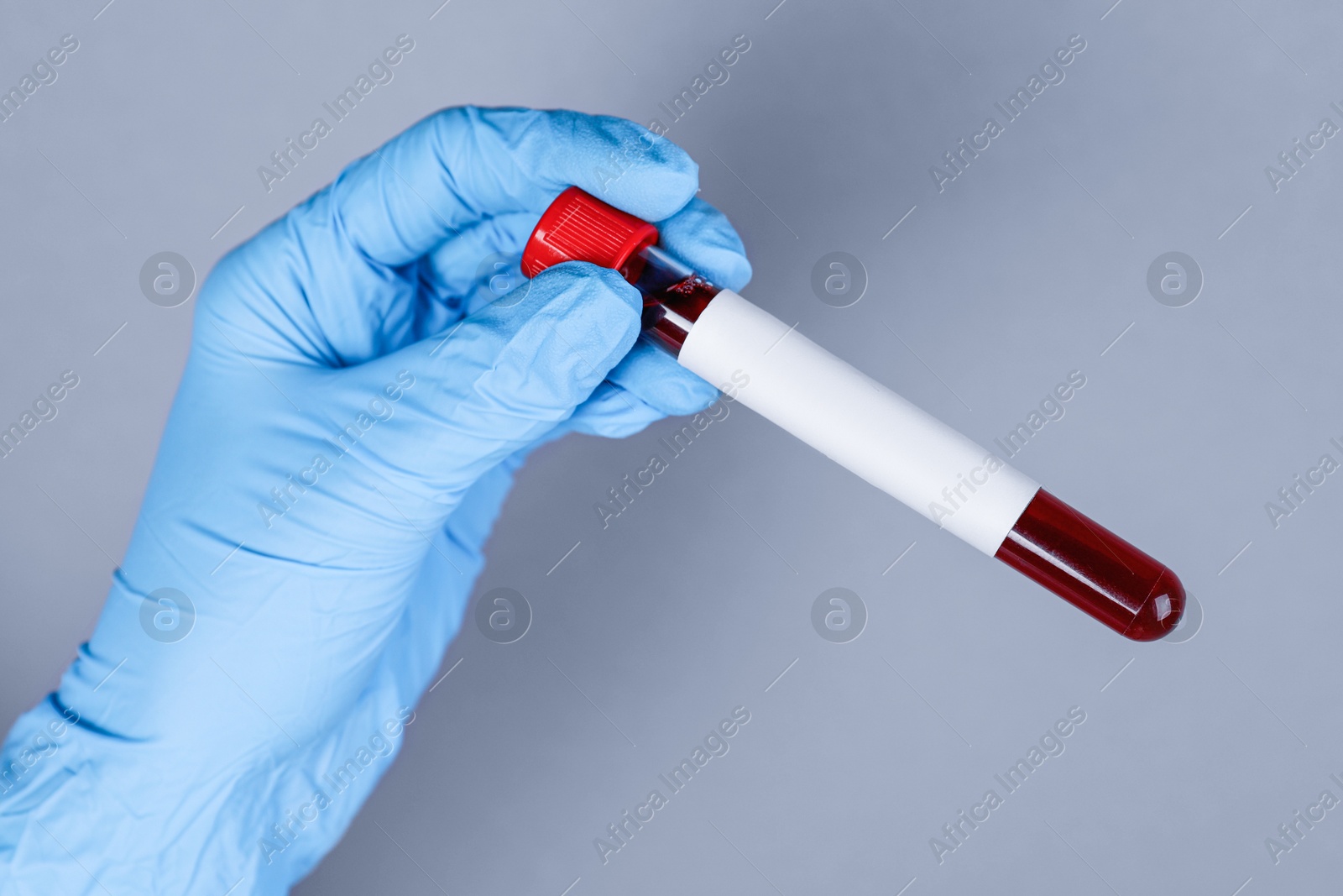 Image of Laboratory worker holding test tube with blood sample and blank label on grey background, closeup. Medical analysis