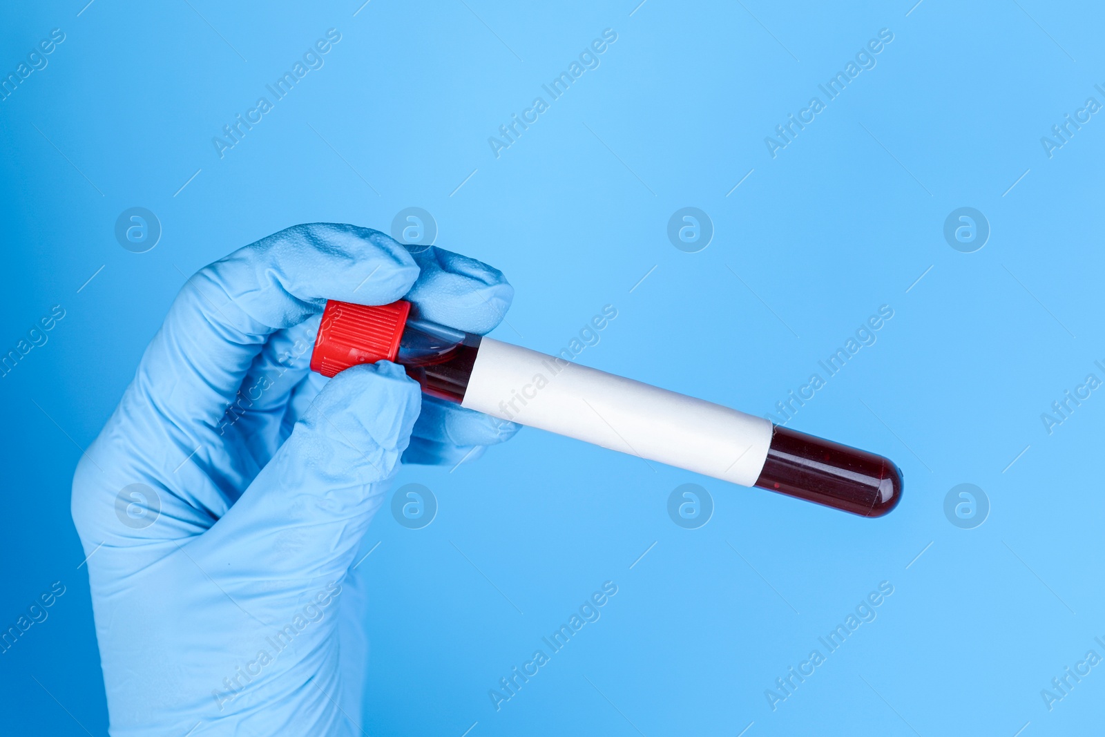 Image of Laboratory worker holding test tube with blood sample and blank label on light blue background, closeup. Medical analysis