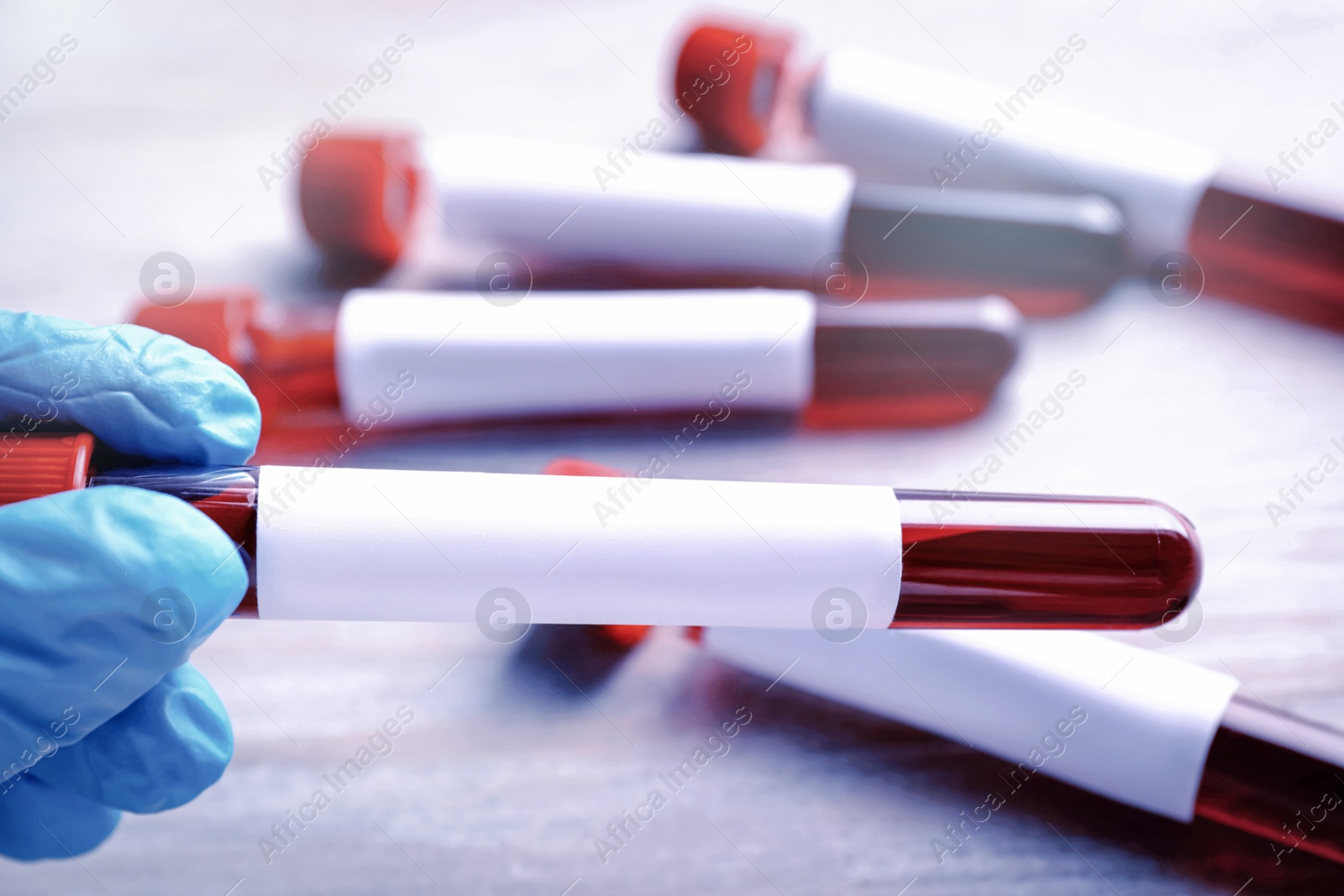 Image of Laboratory worker holding test tube with blood sample and blank label over table, closeup. Medical analysis