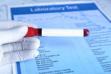 Laboratory worker holding test tube with blood sample and blank label over table, closeup. Medical analysis