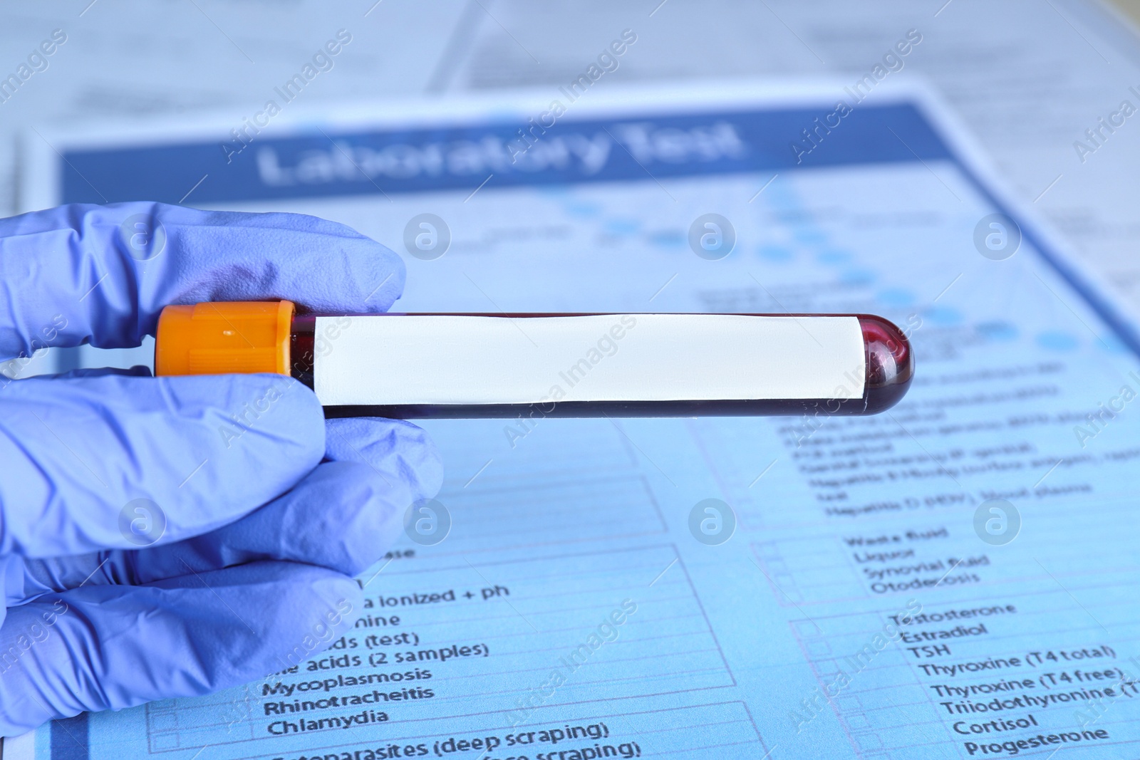 Image of Laboratory worker holding test tube with blood sample and blank label over table, closeup. Medical analysis