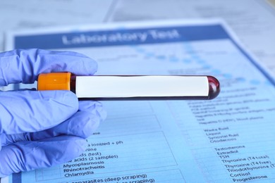 Laboratory worker holding test tube with blood sample and blank label over table, closeup. Medical analysis