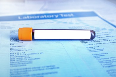 Blood in test tube with blank label on medical form, closeup. Laboratory analysis