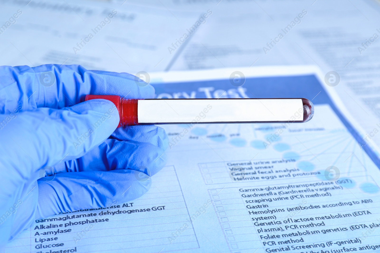 Image of Laboratory worker holding test tube with blood sample and blank label over table, closeup. Medical analysis