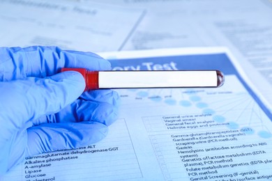 Image of Laboratory worker holding test tube with blood sample and blank label over table, closeup. Medical analysis