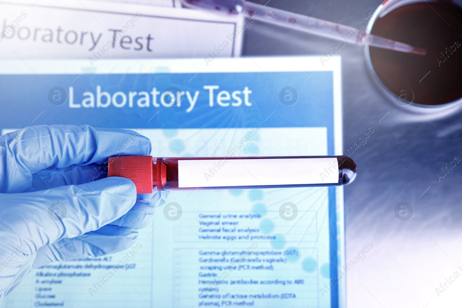 Image of Laboratory worker holding test tube with blood sample and blank label over table, closeup. Medical analysis