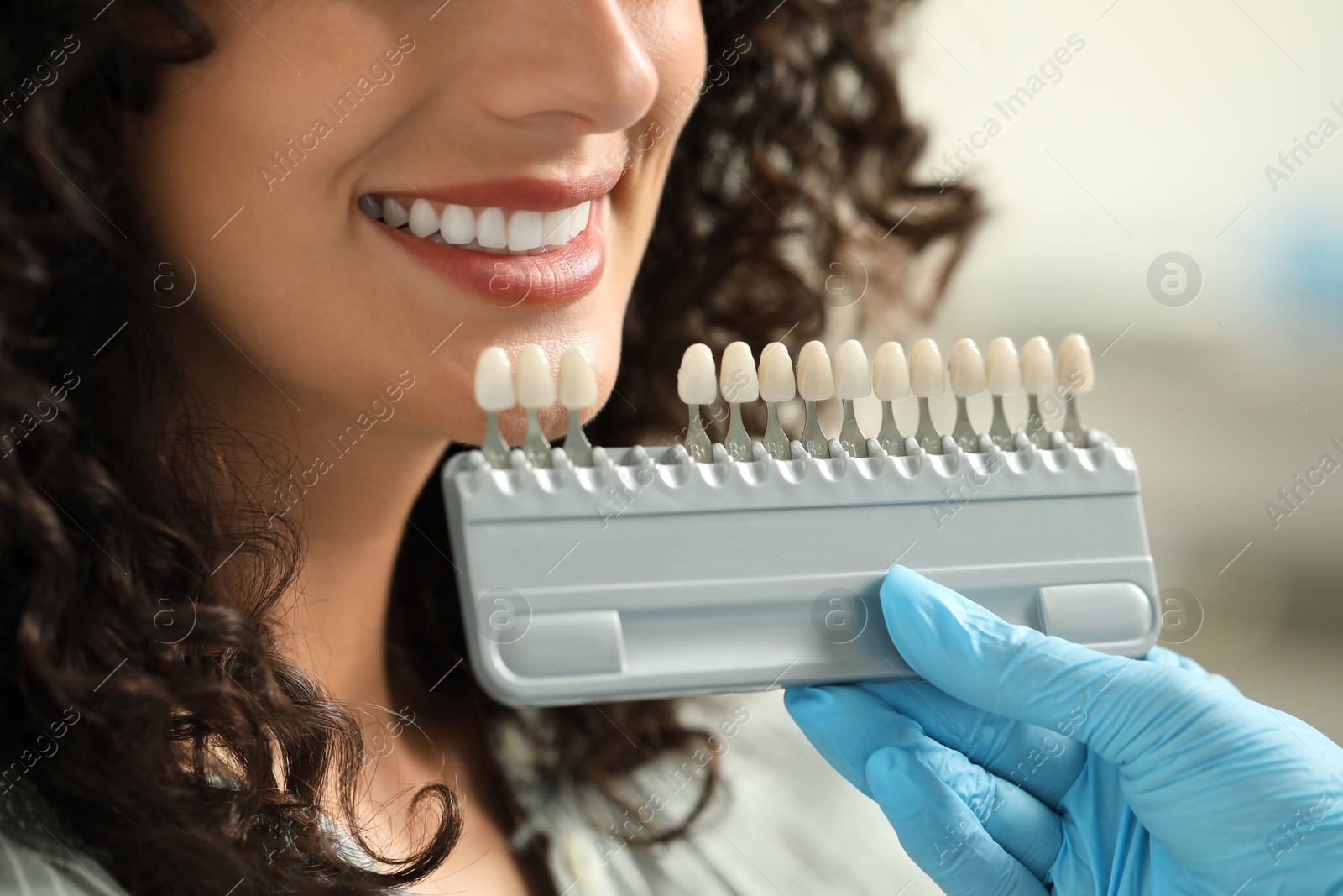 Photo of Doctor checking young woman's teeth color in clinic, closeup. Dental veneers