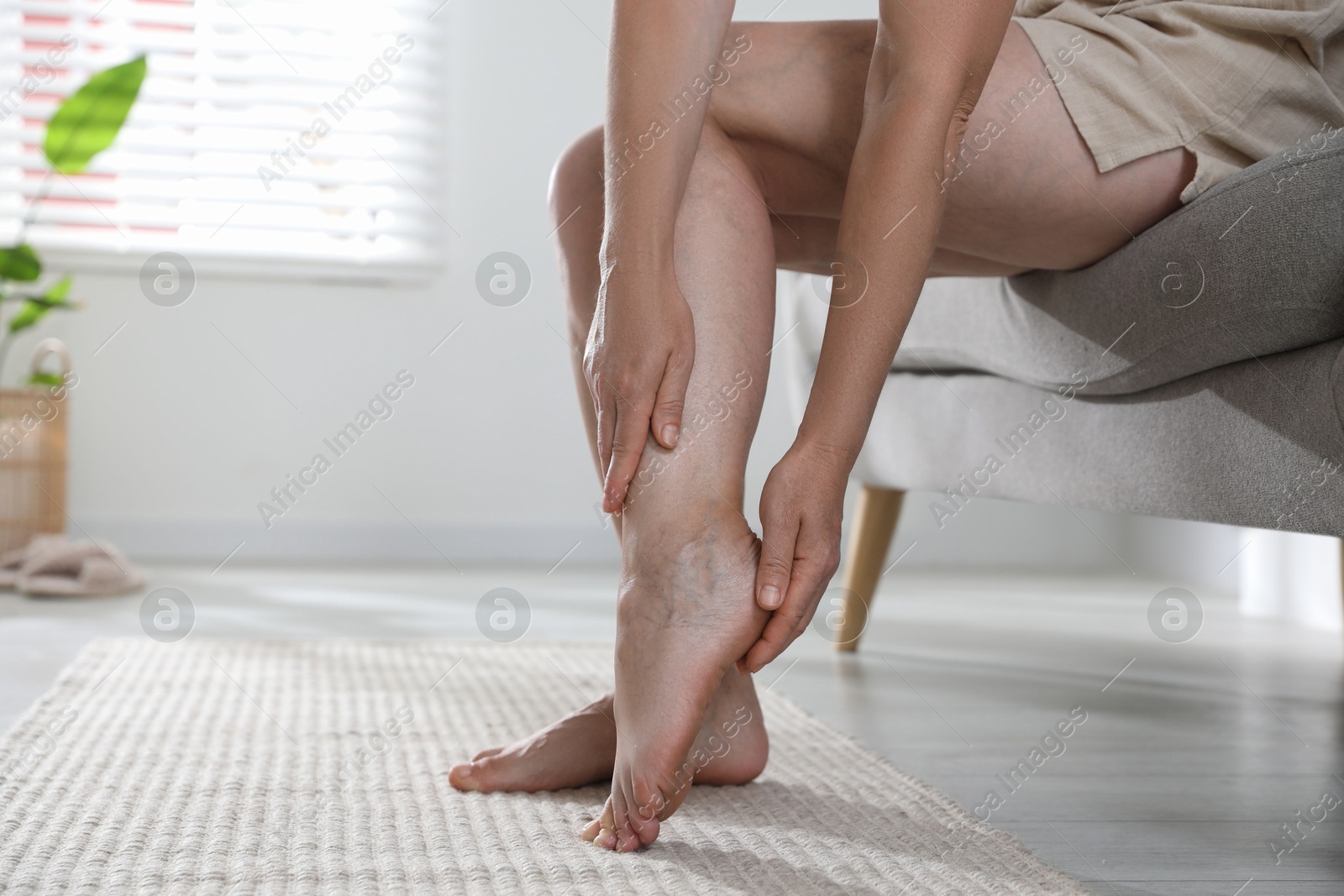 Photo of Woman suffering from varicose veins on sofa indoors, closeup. Space for text