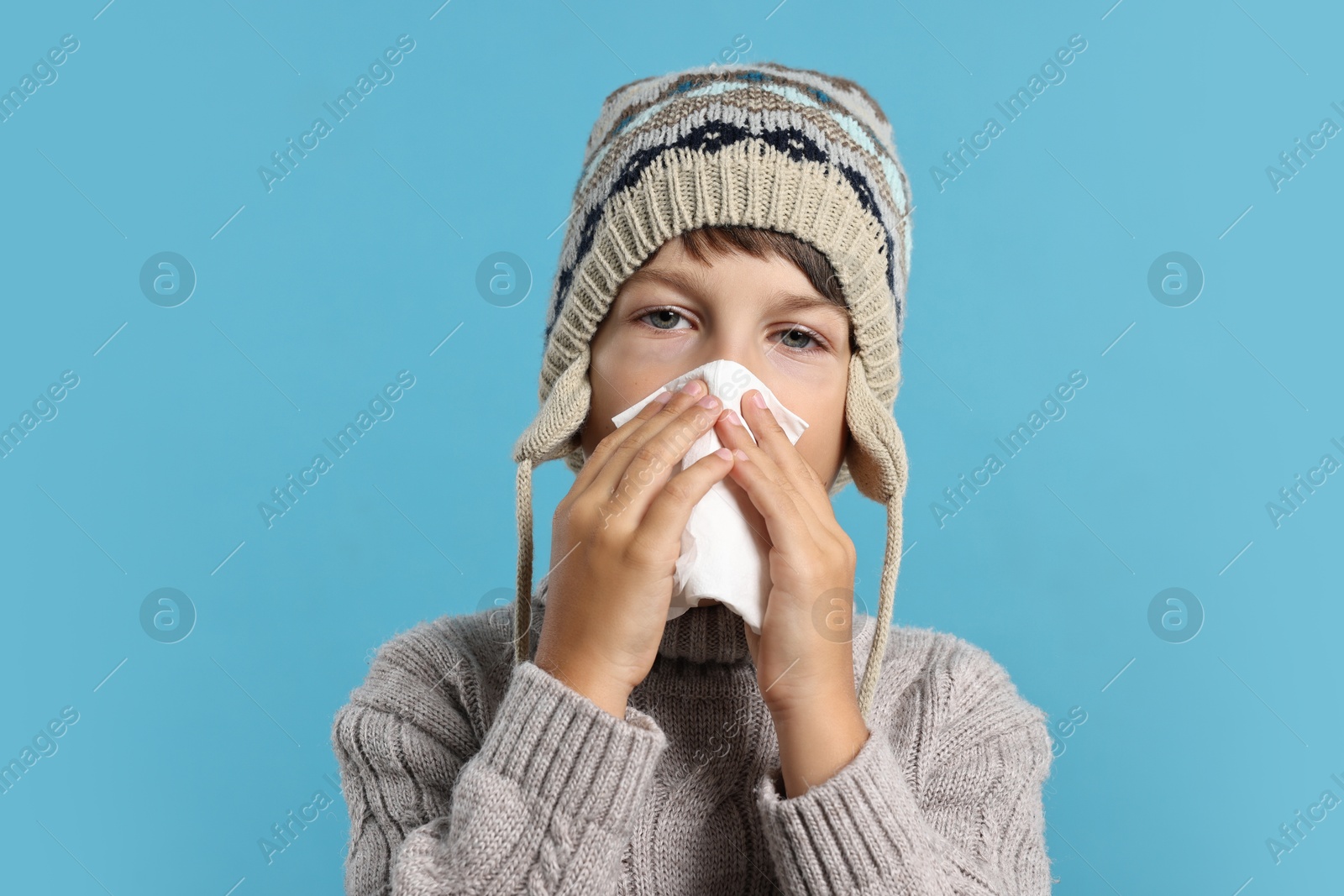 Photo of Cold symptom. Little boy with runny nose on light blue background