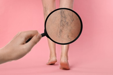 Woman suffering from varicose veins on pink background, closeup. Affected leg, zoomed view through magnifying glass