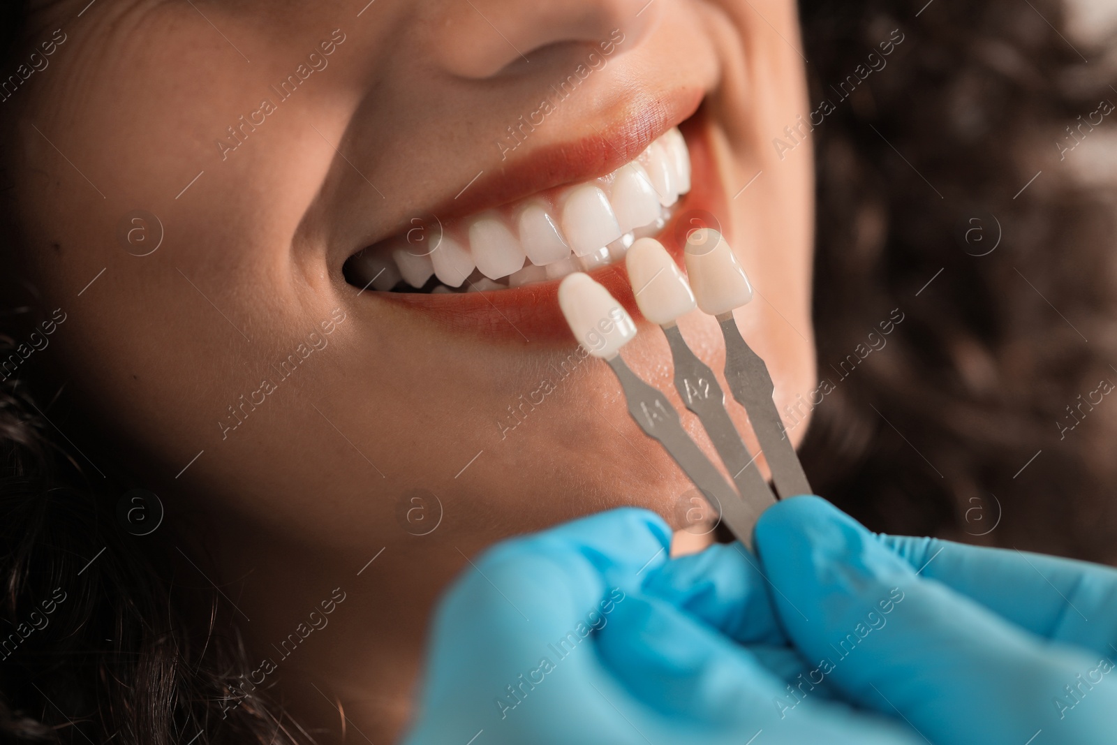 Photo of Doctor checking young woman's teeth color, closeup. Dental veneers