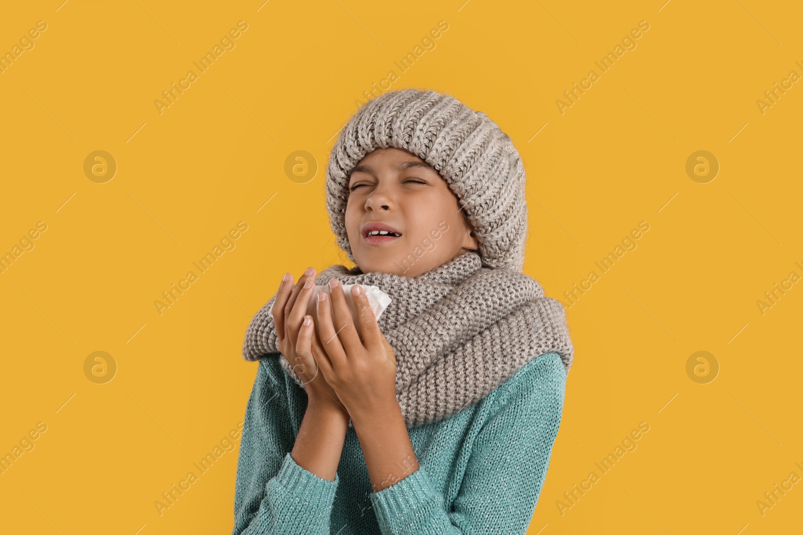 Photo of Cold symptom. Little girl with runny nose on orange background