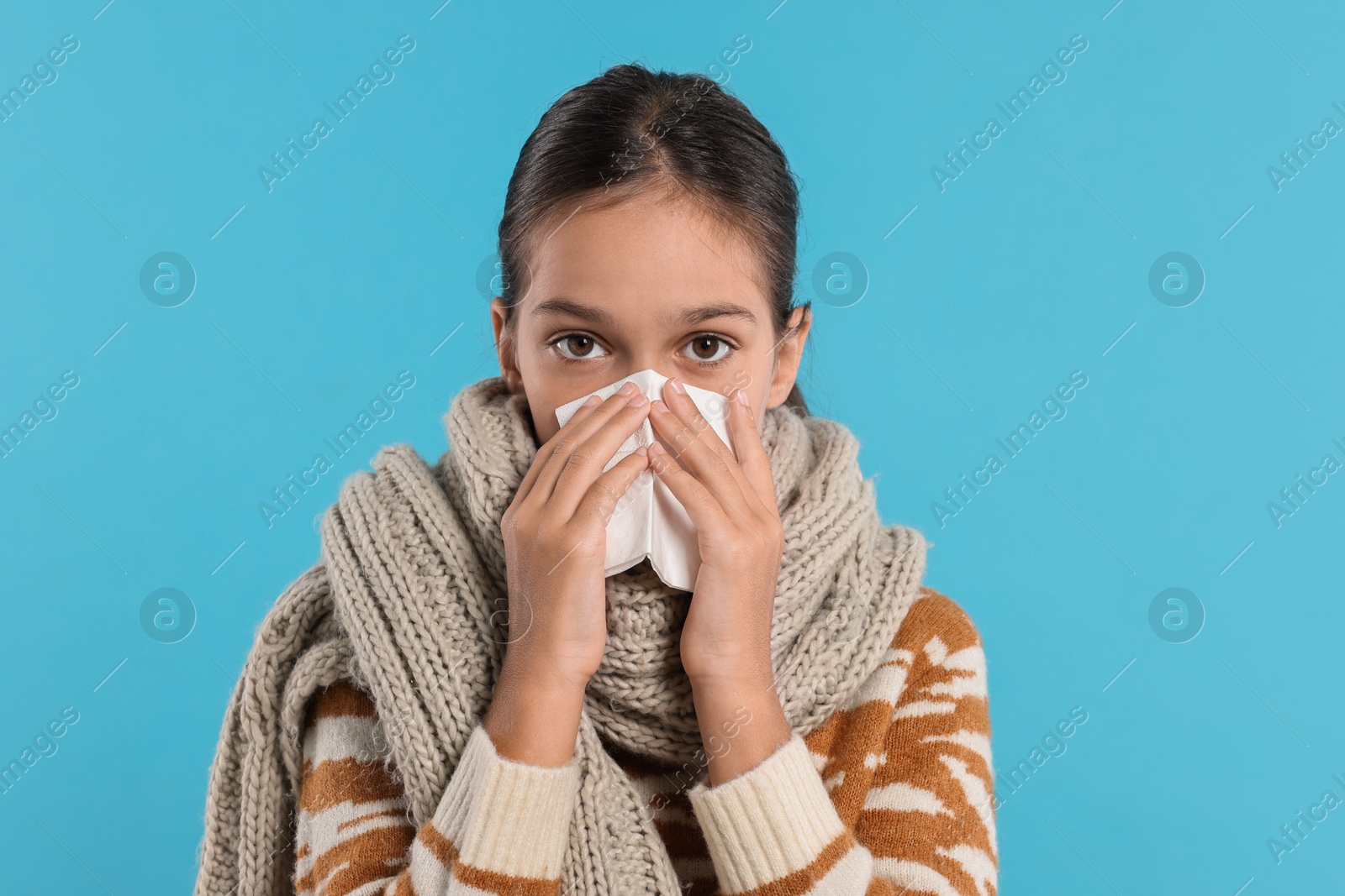 Photo of Cold symptom. Little girl with runny nose on light blue background