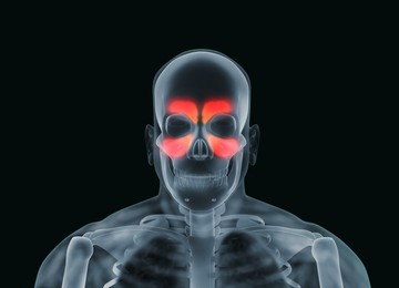Illustration of X-ray picture of man showing nasal cavities on black background, illustration