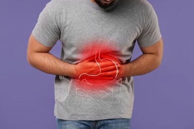 Image of Man suffering from stomach ache on purple background, closeup. Illustration of unhealthy gastrointestinal tract