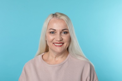 Photo of Smiling woman with perfect teeth on color background