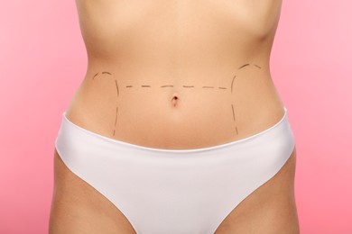 Photo of Slim woman with markings on belly before cosmetic surgery operation on pink background, closeup