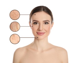 Image of Young woman with skin problem on white background